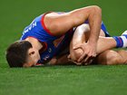 Sam Darcy has appeared to suffer a serious knee injury. 
