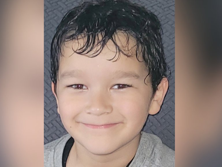 Loyalty Scott was the the victim of a brutal dog attack.