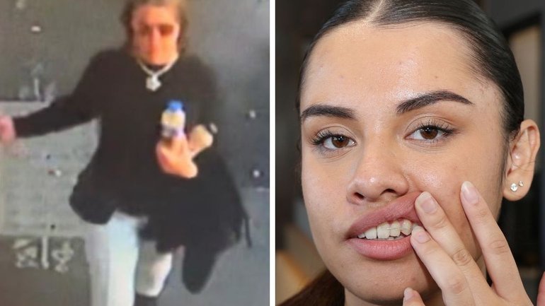 A 19-year-old cafe worker who had a plate smashed into her face, chipping her teeth and leaving her bloody and covered in food, has spoken of the ordeal.