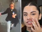 A 19-year-old cafe worker who had a plate smashed into her face, chipping her teeth and leaving her bloody and covered in food, has spoken of the ordeal.