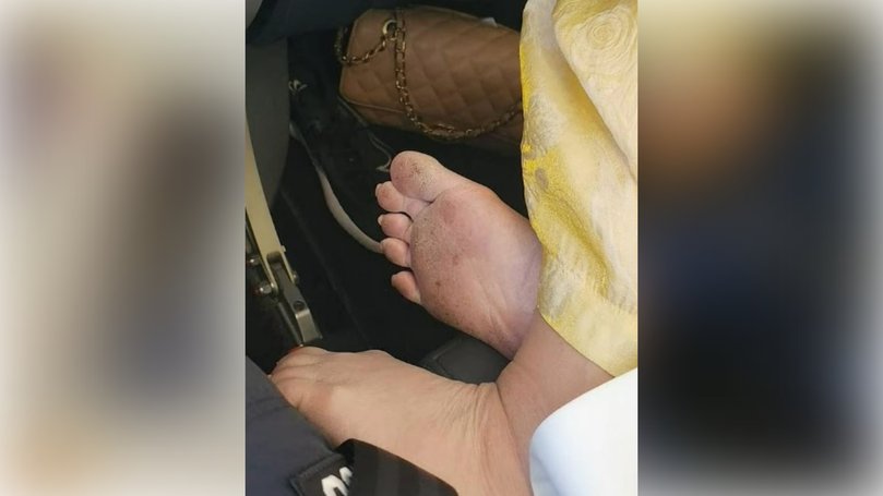 Mr Fok shared photos of the woman's 'crusty' feet.