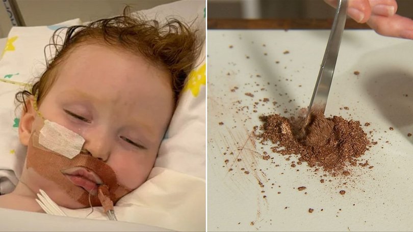 Dustin “Dusty” Wildman remains in intensive care after inhaling a metallic cake decorating powder at his Gold Coast home.