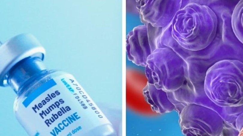 A confirmed measles case has been detected in the Sutherland Shire. Image: Supplied