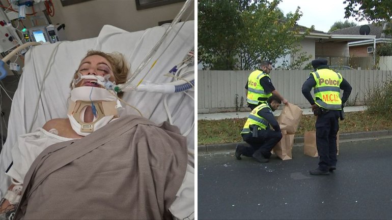 A mother-of-five has been left in an induced coma after she was struck by a car while riding an e-scooter.
