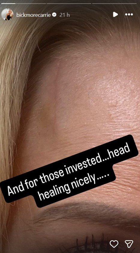 Carrie Bickmore's gash update.