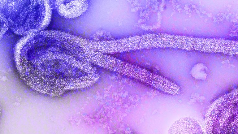 A digitally-colorized electron microscopic image of the Ebola virus in an undated photo provided by U.S. Centers for Disease Control and Prevention. An outbreak of the deadly Ebola virus in the Democratic Republic of Congo and Uganda has prompted the World Health Organization to declare a global health emergency. As of Sunday, May 18, 2026, the CDC said there were reports of more than 330 suspected cases, including nearly 90 deaths in Congo. (Centers for Disease Control and Prevention via The New York Times) — NO SALES; EDITORIAL USE ONLY—