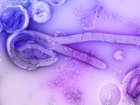 A digitally-colorized electron microscopic image of the Ebola virus in an undated photo provided by U.S. Centers for Disease Control and Prevention. An outbreak of the deadly Ebola virus in the Democratic Republic of Congo and Uganda has prompted the World Health Organization to declare a global health emergency. As of Sunday, May 18, 2026, the CDC said there were reports of more than 330 suspected cases, including nearly 90 deaths in Congo. (Centers for Disease Control and Prevention via The New York Times) — NO SALES; EDITORIAL USE ONLY—