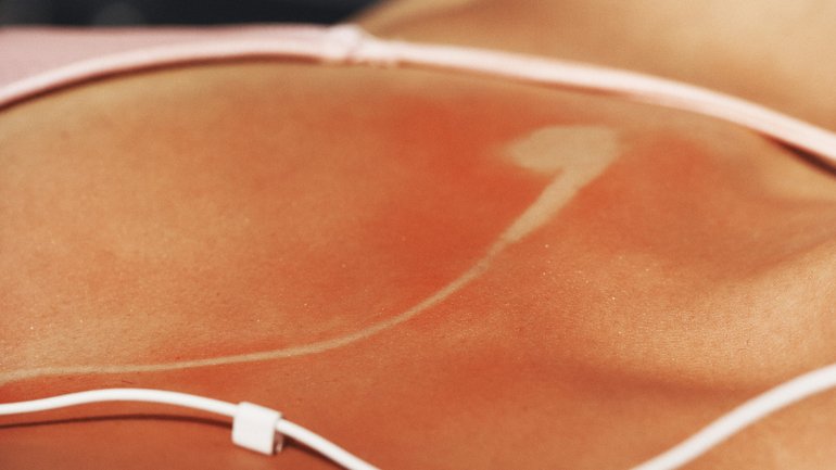Experts say young people could be actively defying the warnings about sun exposure — after all, many grew up hearing them from parents, doctors, and in some cases, school programs. 