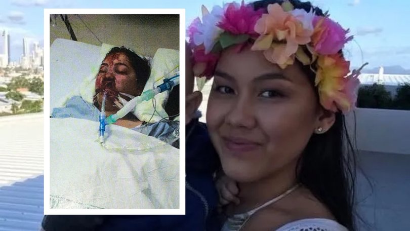 Rachelle Escabarte sustained serious injuries during a 'nightmare' accident in New Zealand.