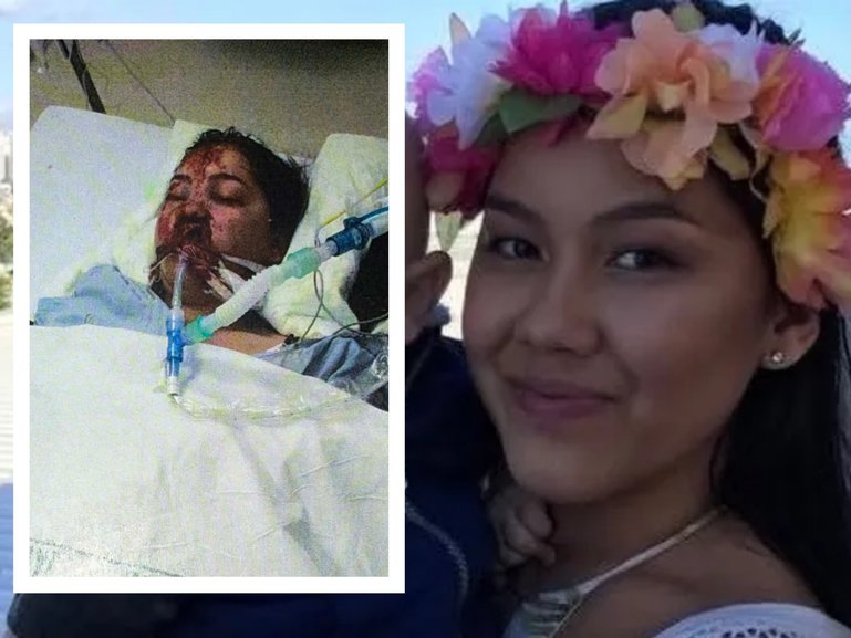 Rachelle Escabarte sustained serious injuries during a 'nightmare' accident in New Zealand.
