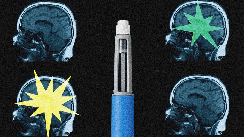Weight loss medications may be rewiring circuits involved not only in appetite, but addiction and cognitive delay.