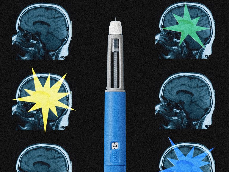 Weight loss medications may be rewiring circuits involved not only in appetite, but addiction and cognitive delay.