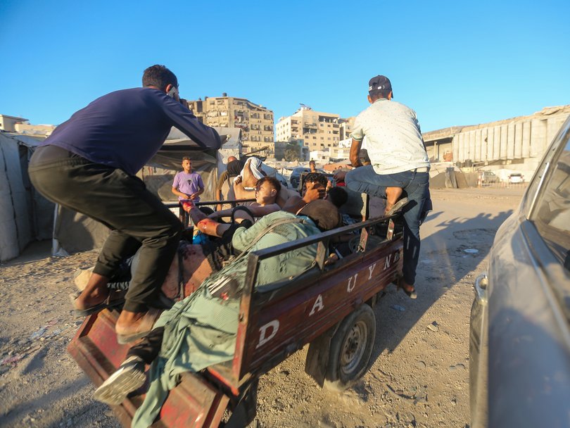 Injured Palestinians are transported to Al-Shifa Hospital via a three-wheeled motorcycle after Israeli air raids in Gaza.