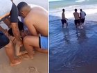 A teenage girl has had her leg torn off in a shark attack off a popular beach, in a shocking incident that came just one day after an 11-year-old boy was also seriously mauled. 