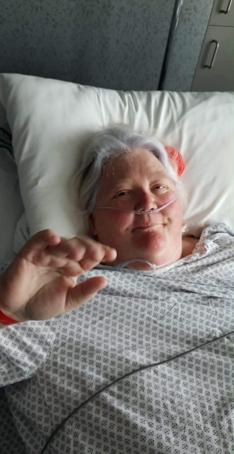 Marsh before the gastric sleeve surgery.