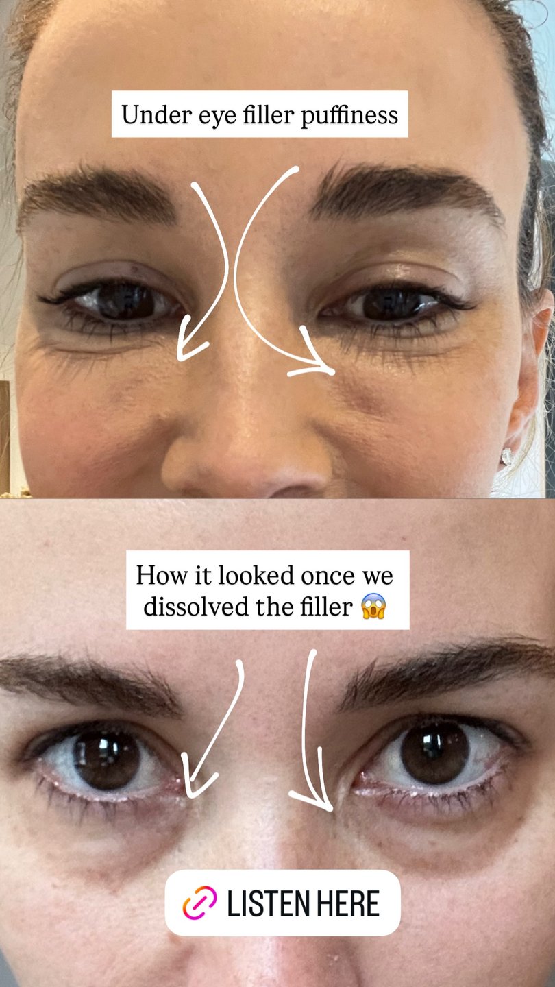 Bec Judd shared pictures from the procedures. 