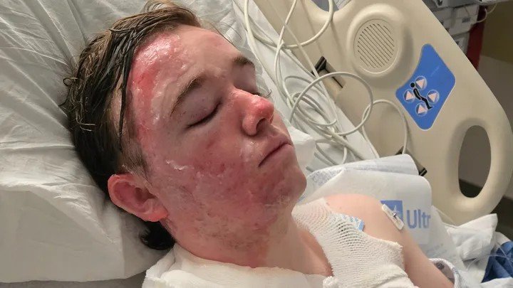 McDonald's horror as worker doused in hot oil.
