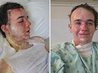 McDonald's worker fights for life after hot oil was thrown on him.