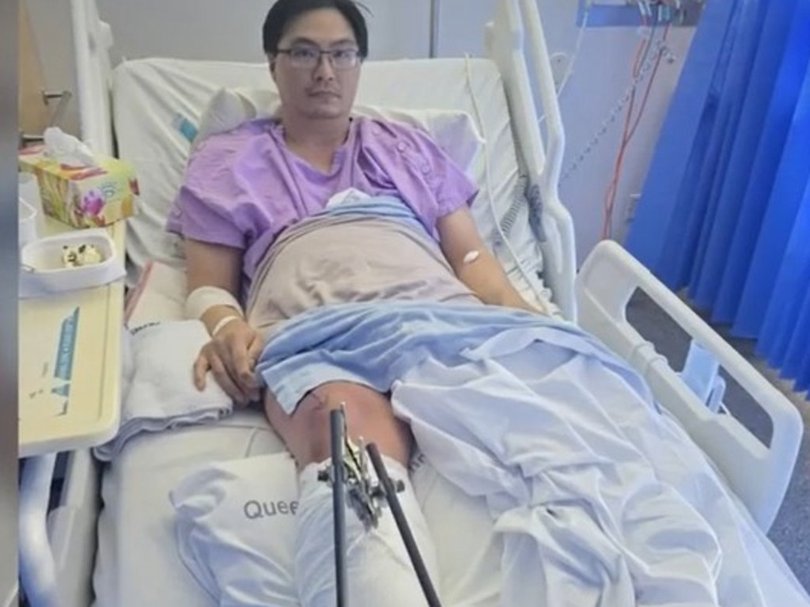 Long Kry sustained a broken leg in the attack. Picture: NewsWire Handout