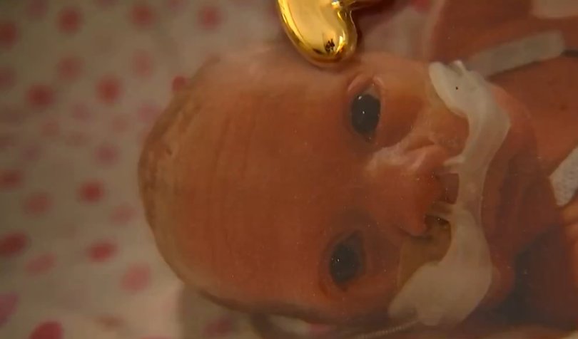 Penelope was born 12 weeks early.