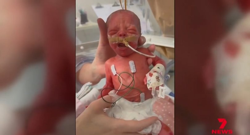 The devastated parents blame the hospital.
