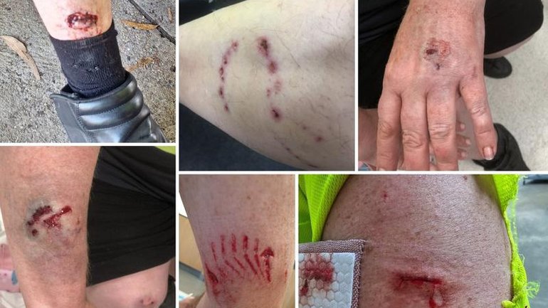 Recent injuries on posties make for grim viewing, prompting a call for people to control their pets. (PR IMAGE PHOTO)