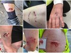 Recent injuries on posties make for grim viewing, prompting a call for people to control their pets. (PR IMAGE PHOTO)
