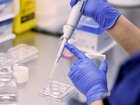 The fertility sector is calling for a national sperm donation register and uniform donor limits. (Dean Lewins/AAP PHOTOS)