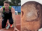 Shannon Winchester nearly died in a motorcycle crash in Bali in 2017 and is now chasing a place at the Los Angeles Paralympics.