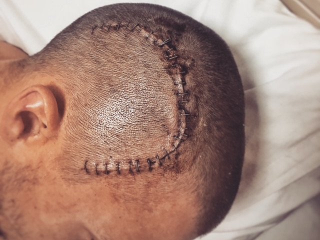 The then-27-year-old underwent emergency brain surgery in Bali after suffering catastrophic head injuries in the crash.