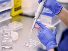 Up to 90 per cent of IVF patients have tried at least one add-on, a researcher says.
