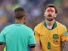 Connor Metcalfe #8 of Australia reacts with a bloodied forehead.