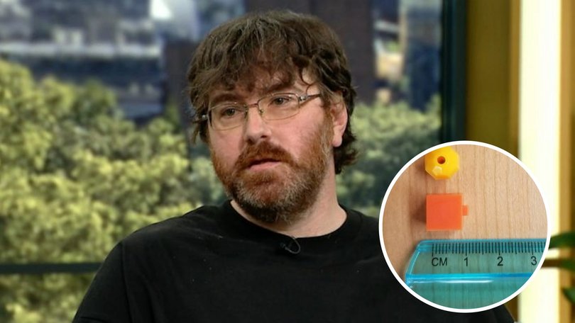 Michael Phillips, from North Carolina, has gained international attention for his micropenis. 