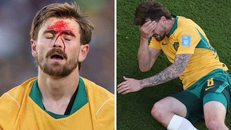 Connor Metcalfe was accidentally kicked in the head in the Socceroos World Cup crunch match against Paraguay.