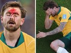 Connor Metcalfe was accidentally kicked in the head in the Socceroos World Cup crunch match against Paraguay.