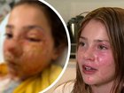 A Queensland family has become the target of a vicious torrent of online abuse after Violet Zerbst suffered severe facial burns when a squishy sensory toy exploded.