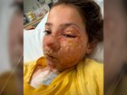 A Queensland family has become the target of a vicious torrent of online abuse after Violet Zerbst suffered severe facial burns when a squishy sensory toy exploded. 