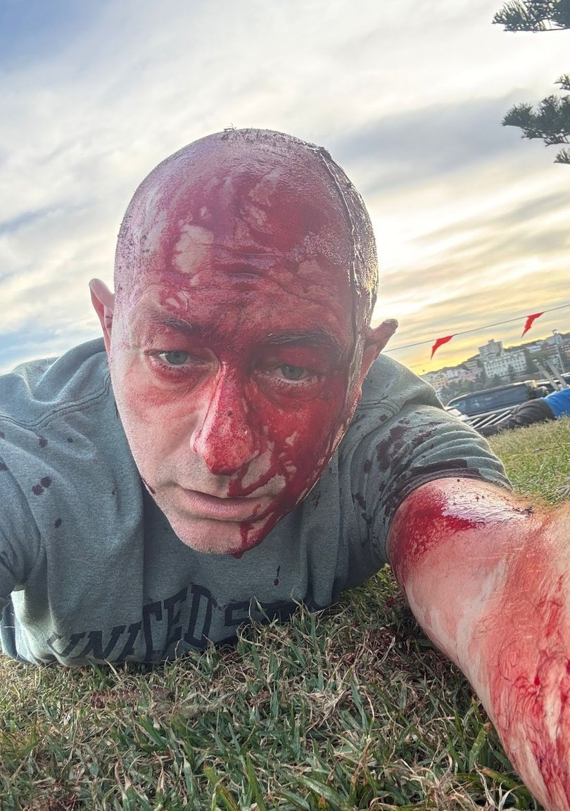 Arsen Ostrovsky was shot during the attack on December 14.
