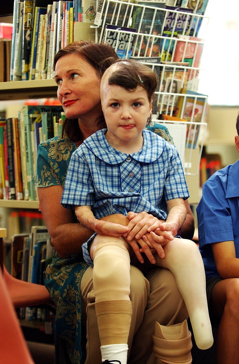 Sophie Delezio with her mother Carolyn Martin for her first day at school in February 2006. 