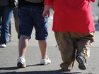 Lifestyle interventions are recommended to prevent cardiovascular complications linked to obesity.  