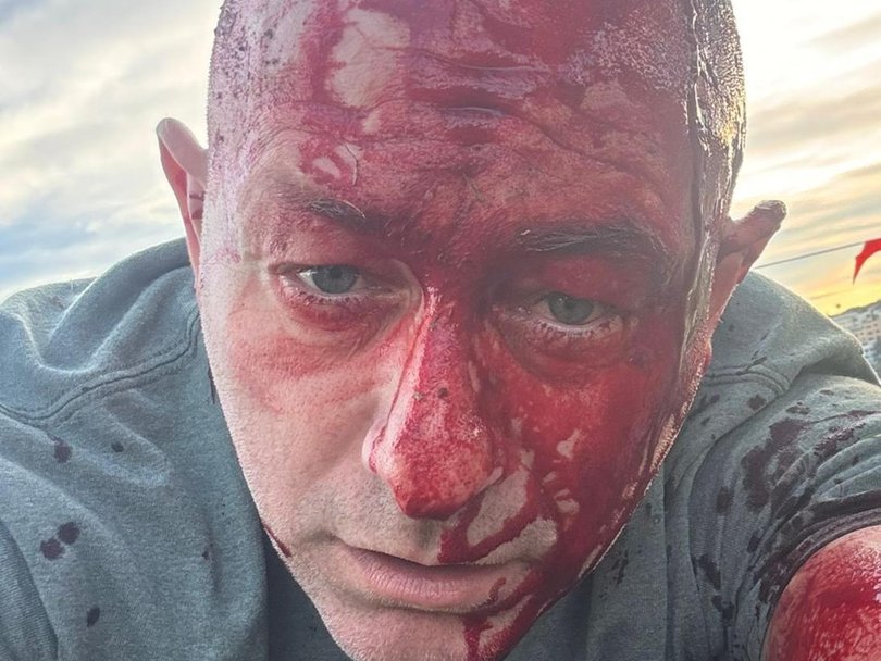 Arsen Ostrovsky was wounded in the terror attack.