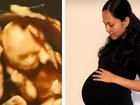 In what is believed to an Australian first, a mum has delivered four naturally conceived, identical girls after a ‘one in 15 million’ pregnancy.