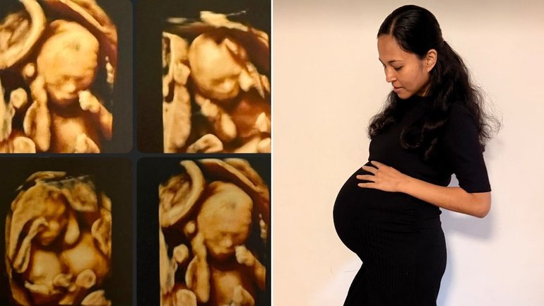 Queensland mother of rare identical quadruplets at risk of losing government-funded rental assistance. 