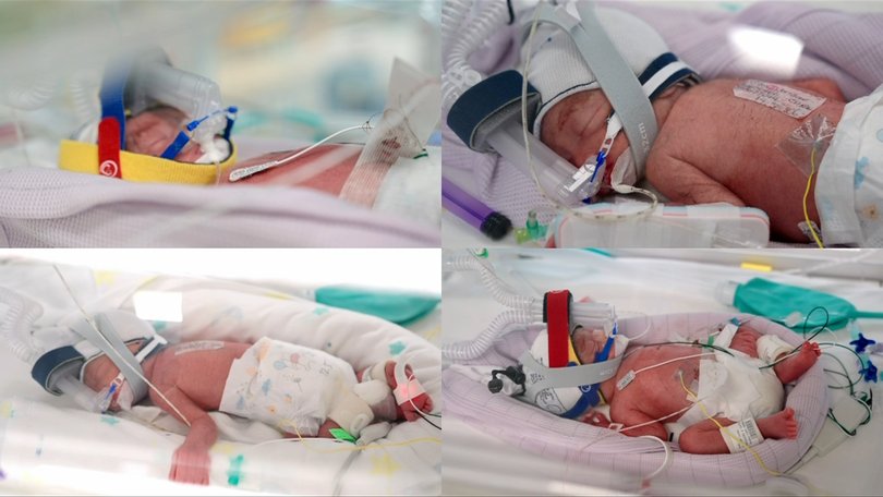 The identical quadruplet girls are receiving specialist care in the Royal Brisbane and Women’s Hospital neonatal intensive care unit.