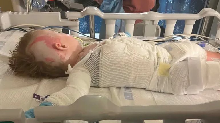 Daelyn Davis is in hospital after a crockpot fell on him.