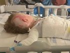 Daelyn Davis is in hospital after a crockpot fell on him.