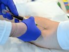 A new blood test can detect the two proteins associated with Alzheimer's disease. 
