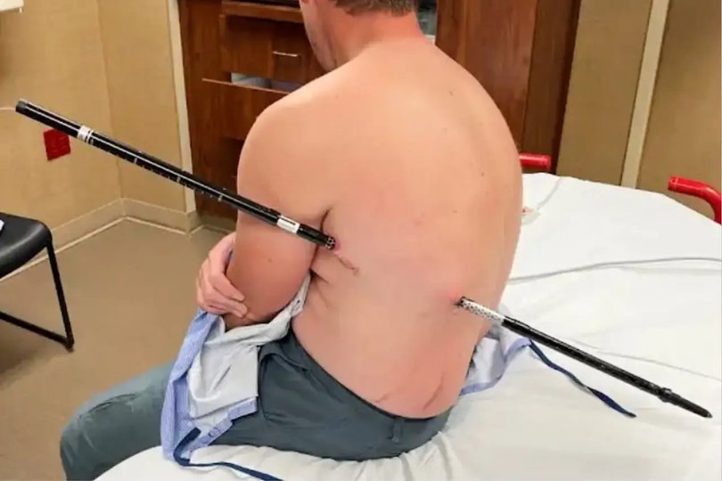 David Cifaldi being treated at the hospital where he works.