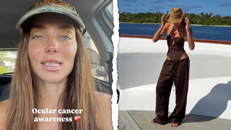 Gold Coast local Tilly Jac Smith revealed she had developed a rare form of eye cancer after she sought medical attention following a surf trip in the Maldives.