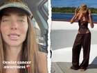 Gold Coast local Tilly Jac Smith revealed she had developed a rare form of eye cancer after she sought medical attention following a surf trip in the Maldives.